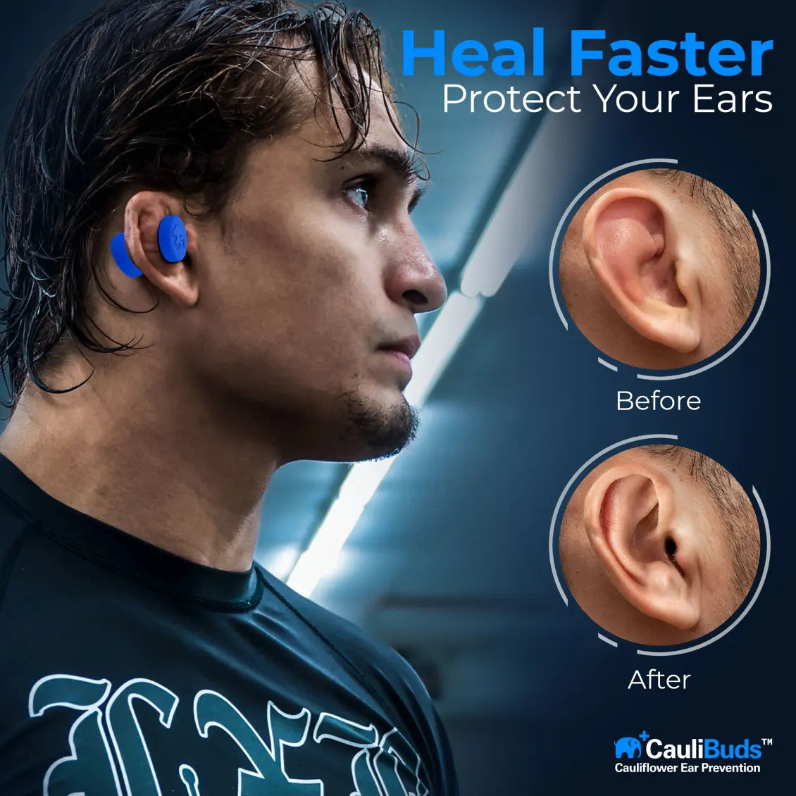 CauliBuds Cauliflower Ear Compression Kit
